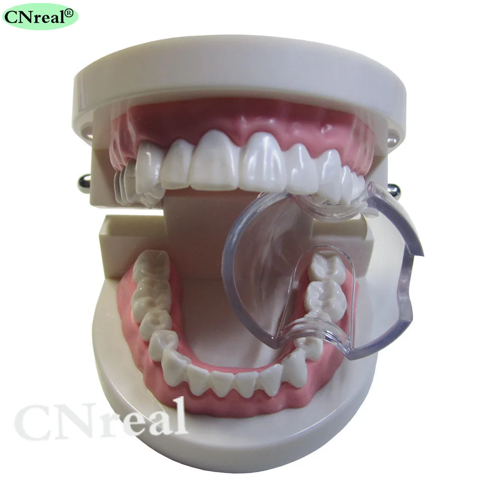 20 шт./лот, стоматологический Автоклавный расширитель для губ, расширитель для щек, открывалка для рта для отбеливания задних зубов, интраоральные принадлежности