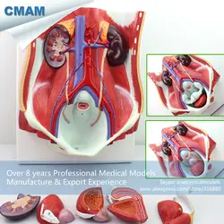 12426 CMAM-UROLOGY06 съемный орган, анатомия модель мочевыделительной системы на борту, медицинская наука образования анатомические модели