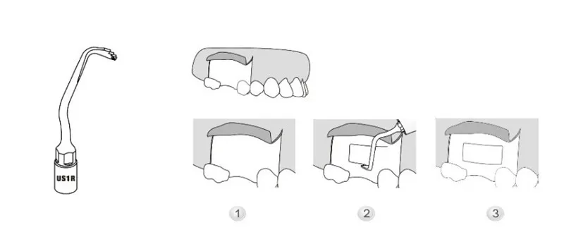 3 шт. US1R, режущая пластина для зубов режущая насадка Стоматологическая для резки костей в труднодоступных позициях с лучшей эффективностью