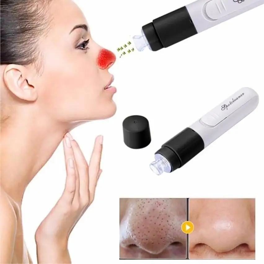 

Handheld Electric Blackhead Remover Cleaner Vacuum Suction Facia Blackhead Removal Skin Care Cleansing Tool 2U1115