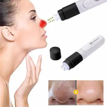 

Handheld Electric Blackhead Remover Cleaner Vacuum Suction Facia Blackhead Removal Skin Care Cleansing Tool 2U1115