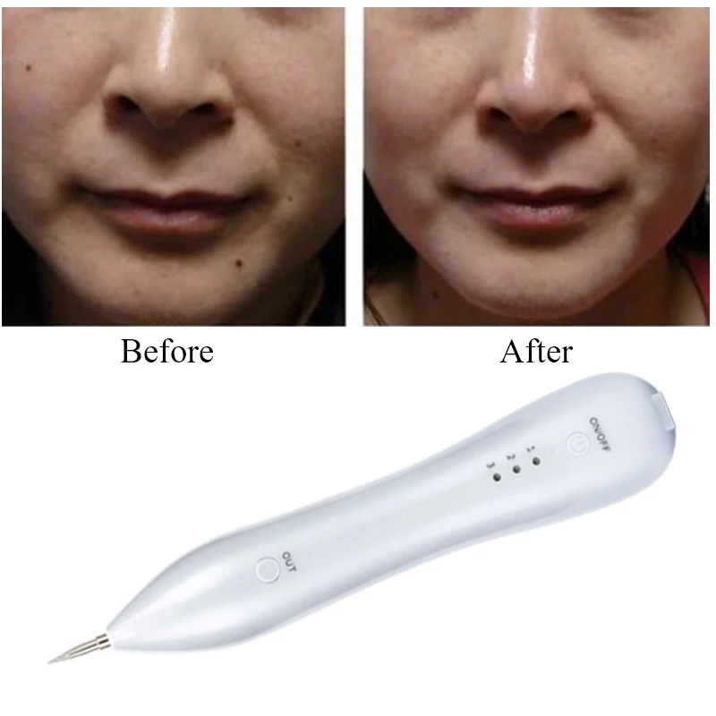 Warts removal machine Skin Care Laser Mole Freckle Removal Pen Tool Tattoo Removal Machine Spot Pen Salon Home Beauty Device