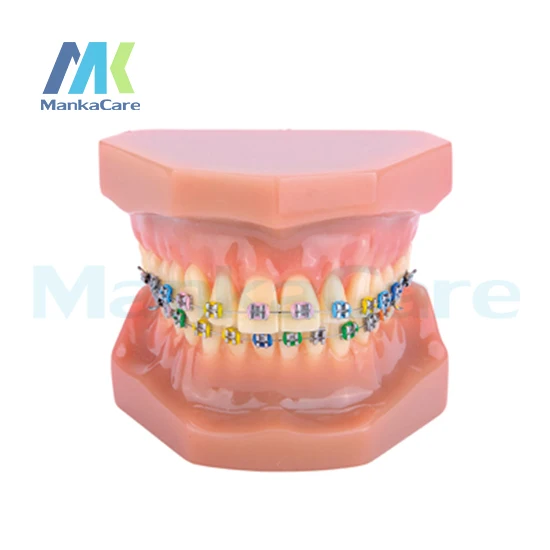 

Manka Care - 28 pcs Tooth, all metal bracket Oral Model Teeth Tooth Model