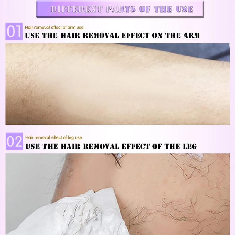 125ml Aloe Facial Beard Permanent Hair Removal Cream Stop Hair Growth Inhibitor 10pcs Facial Special Wax Paper for Summer