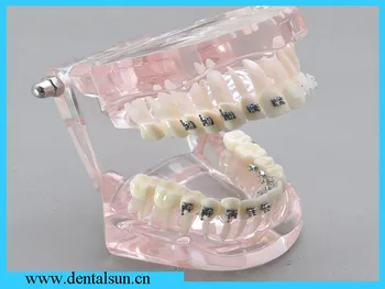 

TeethTraning Model/tooth brushing instruction model/Ortho Metalceramic bracket Model/orthodontic Teeth model/Dental Teeth Model