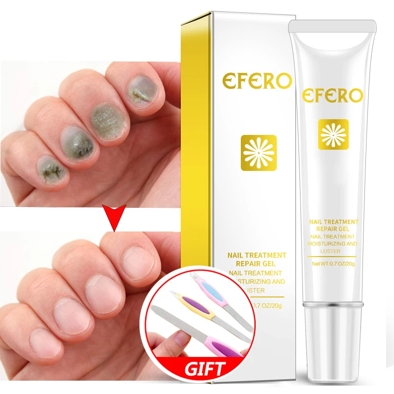 

EFERO Nail Repair Essence Serum Remedy Nail Fungus Treatment Remove Onychomycosis Whitening Toe Nails Hand Foot Skin Care 20g