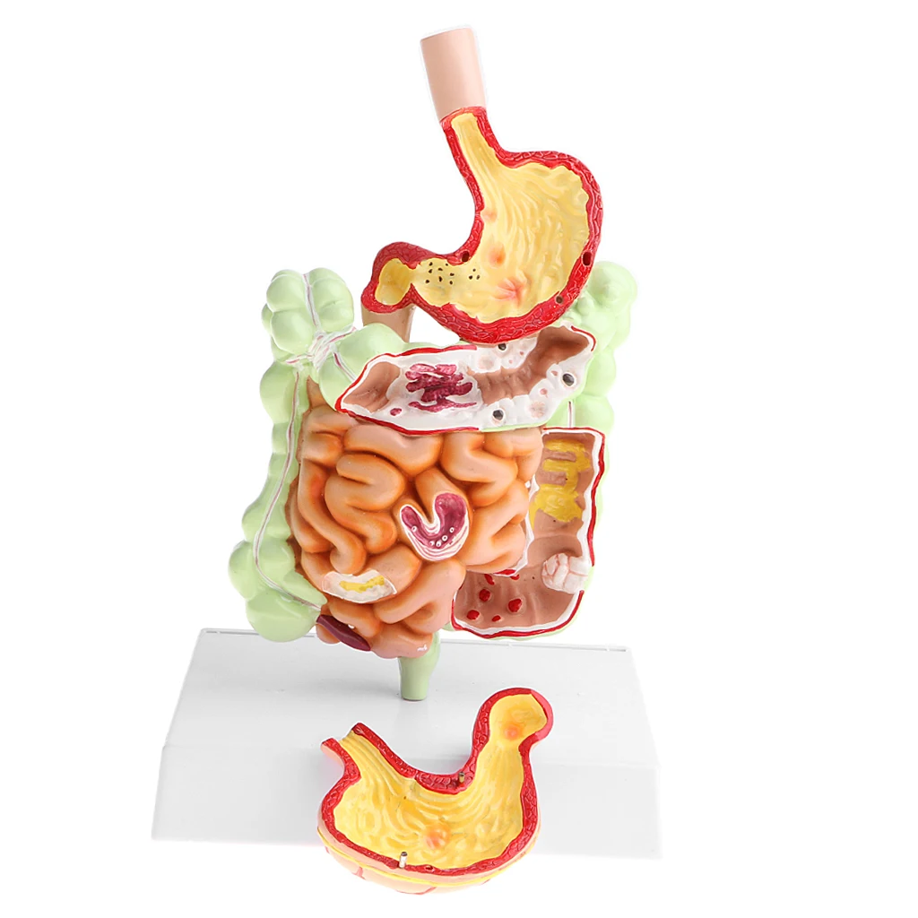 

Minified 1 Time Human Large Intestine Stomach Pathology Model Disc Laboratory Learning Equipment