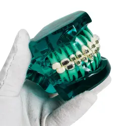 Стоматологический ортодонтический научить исследование зубов Модель ментальные и керамический кронштейн
