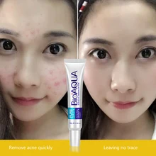 Bioaqua 30g Anti Acne Cream / Oil Control / Shrink Pores/ Acne Scar Remove/ Face Care Skin Care Bioaqua 30g Anti Acne Cream / Oil Control / Shrink Pores/ Acne Scar Remove/ Face Care Skin Care
