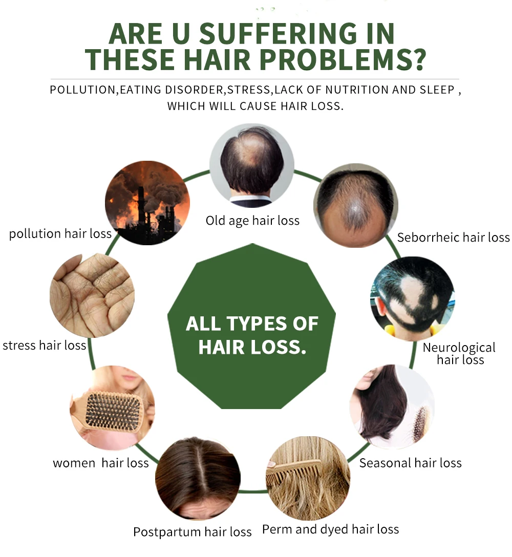 2 шт Органический Женьшень для роста волос тоник для тонких для мужчин и женщин Продукты для выпадения волос