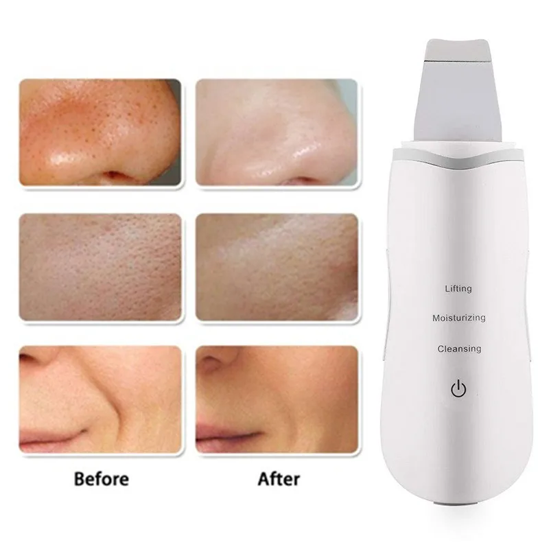 Purificador da Pele do Rosto Recarregável Ultrasonic Limpador Facial Peeling Ferramentas Vibração Remoção Cravo Esfoliante Poros Mais Limpo Mod. 1210932 10 Cheap Utensílios de cuidado facial