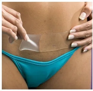 Macure 7.5CM*4.5CM Silicone Gel Scar Therapy Patch 1 Piece be Washed and Reused