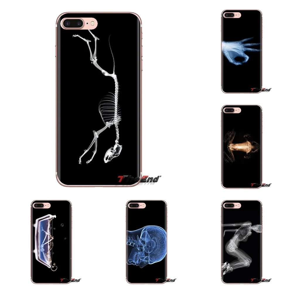 X-Ray Fashion Transparent Soft Shell Covers For Samsung Galaxy J1 J2 J3 J4 J5 J6 J7 J8 Plus 2018 Prime 2015 2016 2017 |