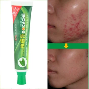 

Acne Cleaning Cream Skin Care Remove Repair Comedone Pimple Acne Quickly Face Acne Cream Remover Anti Acne HOT