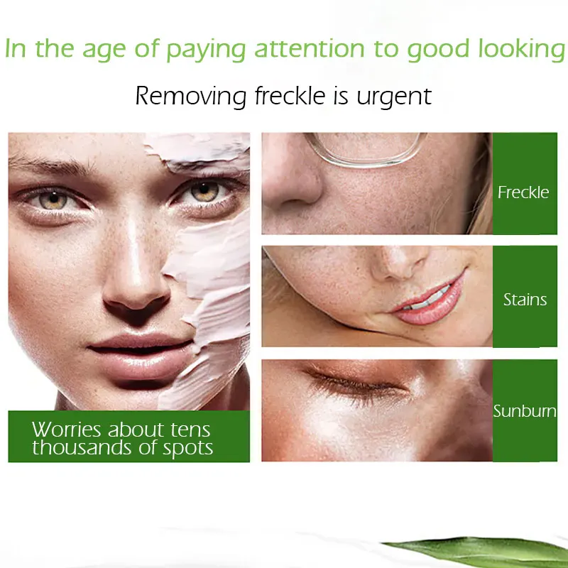 cream to reduce age spots