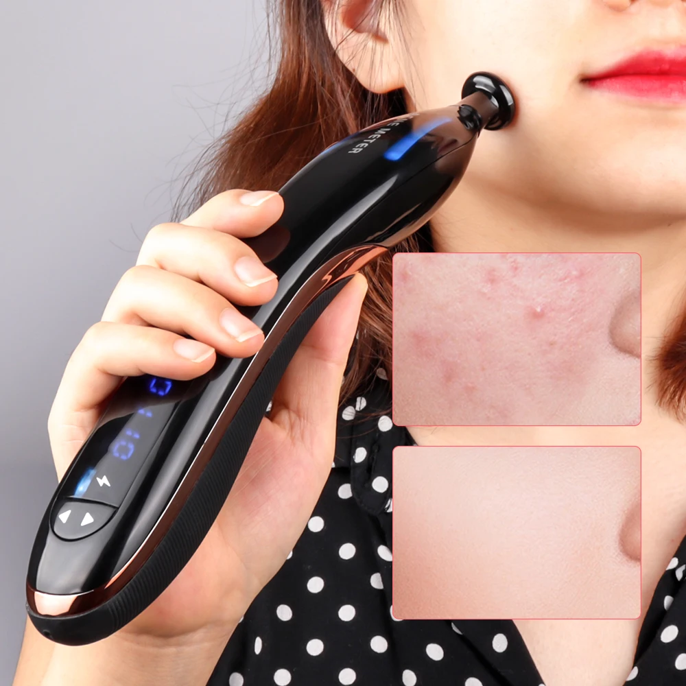 Máquina de Remoção Cuidados com a Pele Nova Azul Caneta Plasma Cicatriz Acne Anti Rugas Envelhecimento Terapia Tratamento Beleza Dispositivo Facial Luz 2 acne tratamento caneta beleza dispositivo cuidados com a pele facial