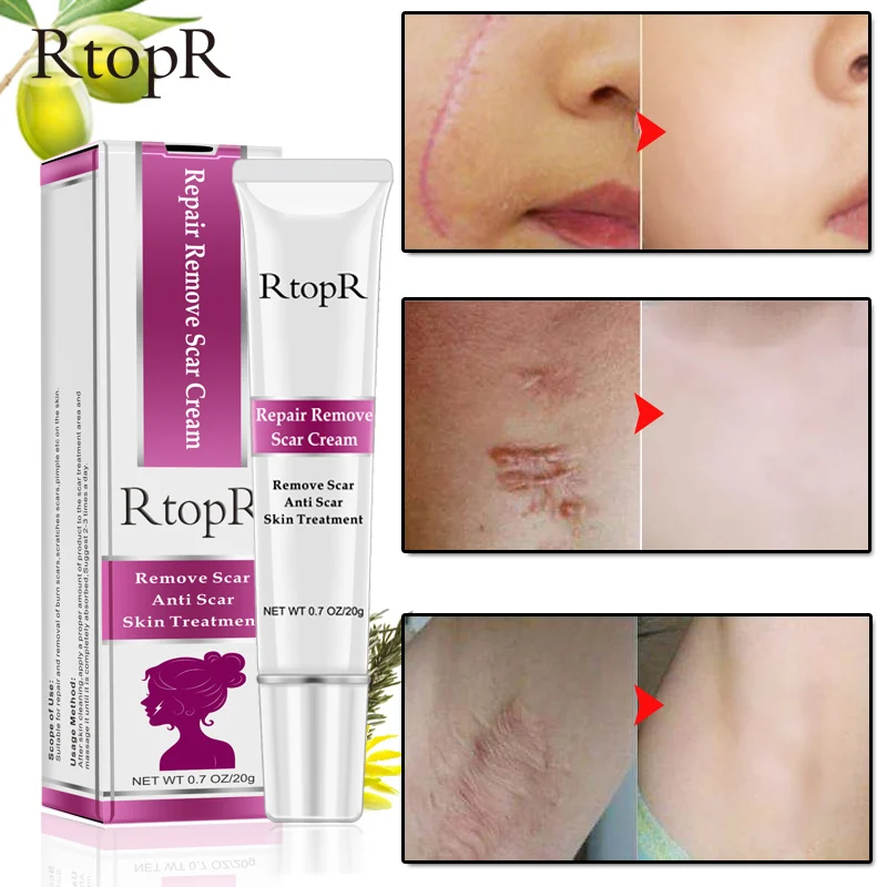 

RtopR Acne Scar Removal Cream Skin Repair Face Cream Acne Spots Acne Treatment Blackhead Whitening Cream Stretch Marks 20ml