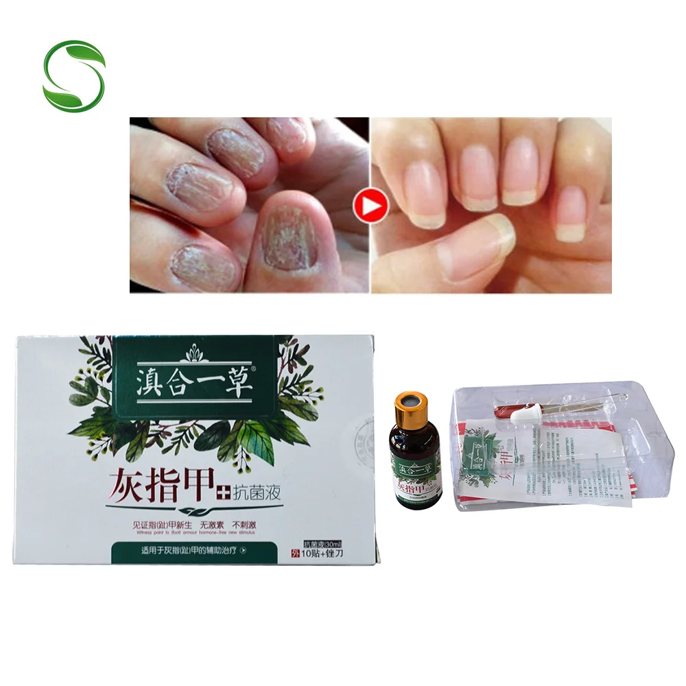 1 Pack Remedy For Nail Fungus Treatment Feet Care Whitening Toe Nail