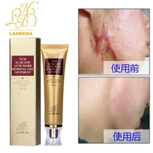 LANBENA Удаление Шрама от акне Кожи Крем восстанавливающий крем для лица акне пятна лечение акне отбеливание чёрных точек крем стрейч Знаки 30 мл