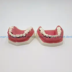 Хорошее качество Стоматологическая Пародонтоз модель/зуб Спецодежда медицинская модель