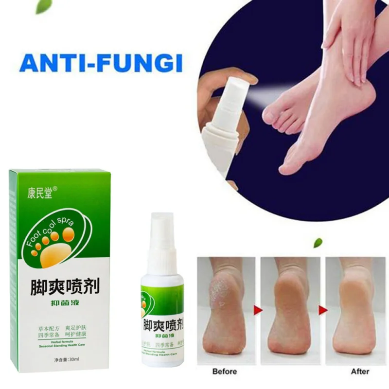 30 мл средство для удаления пластырей для ног Антибактериальный запах пота бактериостатический растительный травяной спрей для четырех сезонов