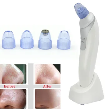

Facial Pore Vacuum Suction Cleaner Blackhead Acne Remover Utilizes Pore Vacuum Extraction Tool Comedo Facial Skin Care Machine