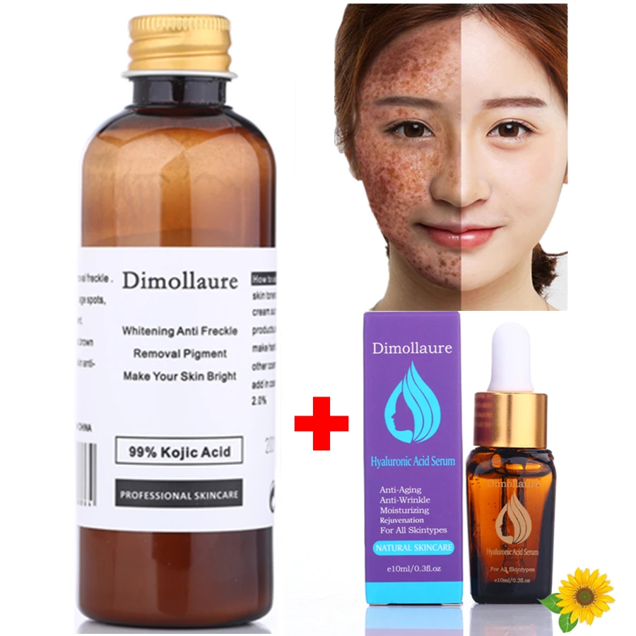 Dimollaure 30g pure Kojic Acid whitening cream+Hyaluronic acid serum removal Freckle Acne scar pigmentt melanin Wrinkle cream