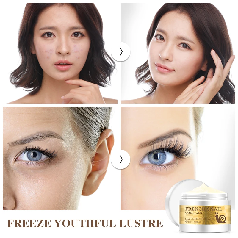 Snail-face-cream-hyaluronic-acid-moisturizer-anti-Wrinkle-anti-aging-nourishing-collagen-snail-serum-day-cream (1)