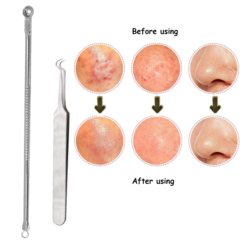 1 Набор игл для удаления угрей, инструмент для удаления угрей, набор инструментов для удаления угрей, инструмент для удаления угрей, инструмент для очистки лица