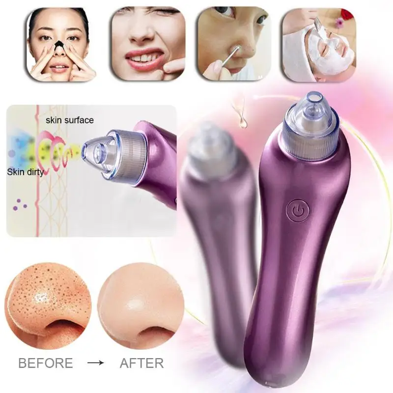 

Vacuum Pore Cleaner Face Blackhead Acne Black Spot Removal Suction Machine Cleansing Face Facial Instrument