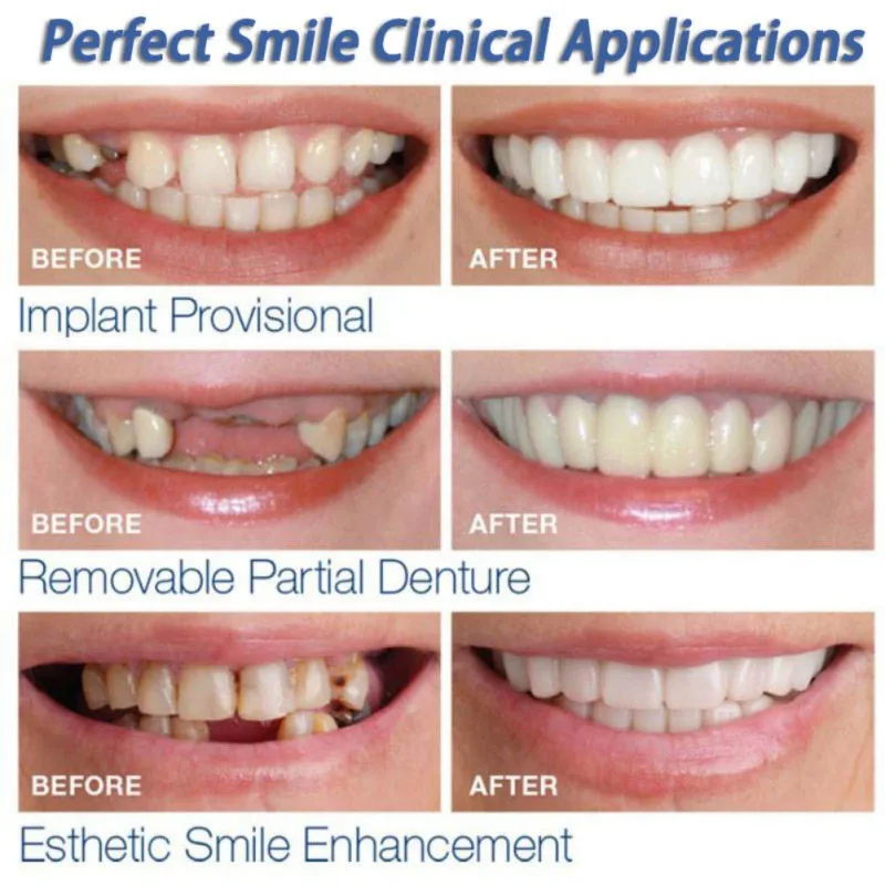 Whitening Tooth paste Silicone Simulation Braces Perfect Instant Smile Comfort Fit Flex Curved Teeth Dentures Beauty 3