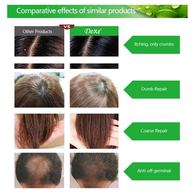 Анти-шампунь против выпадения волос Профессиональный Китайский травяной рост волос лечение Предотвращение волос толстое средство для