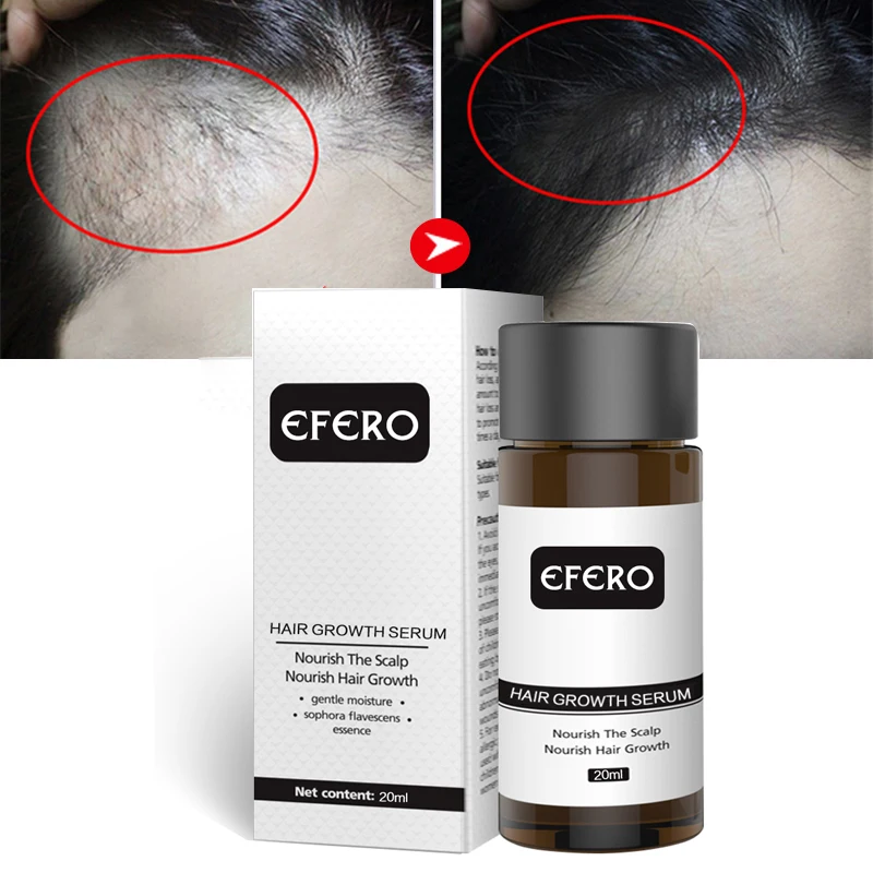 EFERO Hair Growth Serum Essence Hair Loss Product Hair Care Growth Serum Beard Essence Beard Growth Treatment 20ml