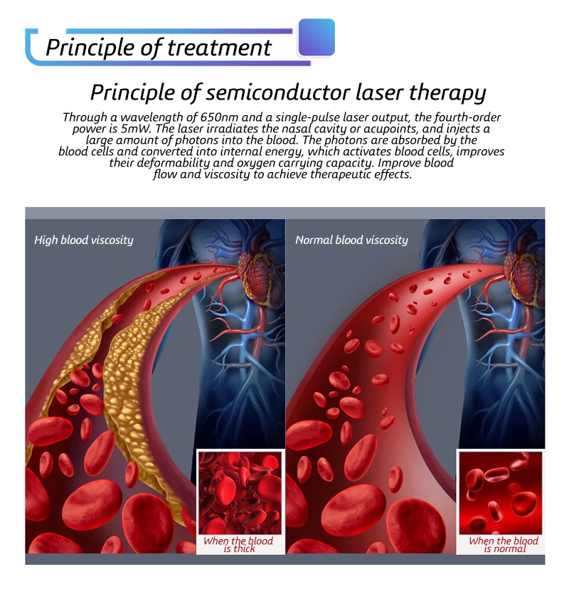 Портативный лазерный терапевтический инструмент для лечения тромбоза снимает гиперлипидемию гипервязкость гипертония холестерина церебральный