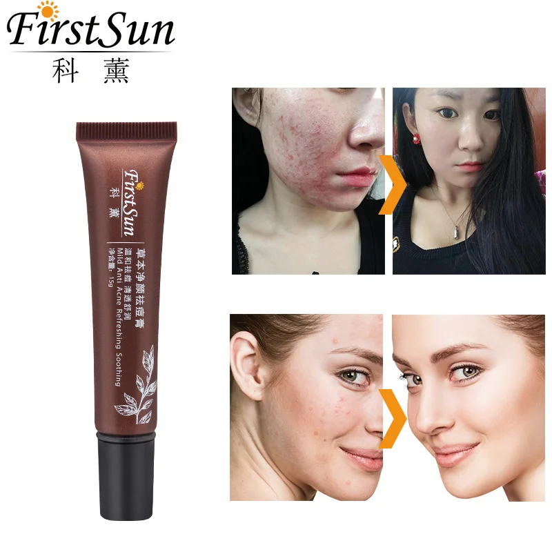 Firstsun травяной антиакне крем для лица меласма Крем лечения шрамов от акне