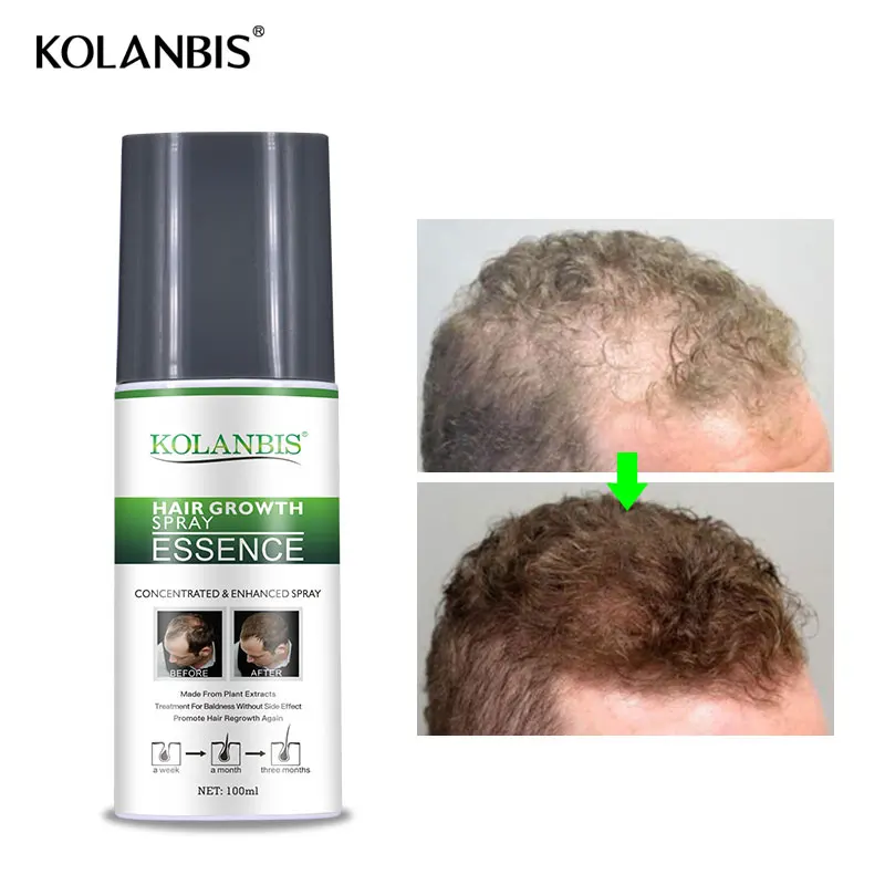 3 botellas de ginseng estimulan el crecimiento suero spray para la caída del pelo folículo cuero cabelludo tratamiento hombre crecimiento espesante producto recrecimiento - 6