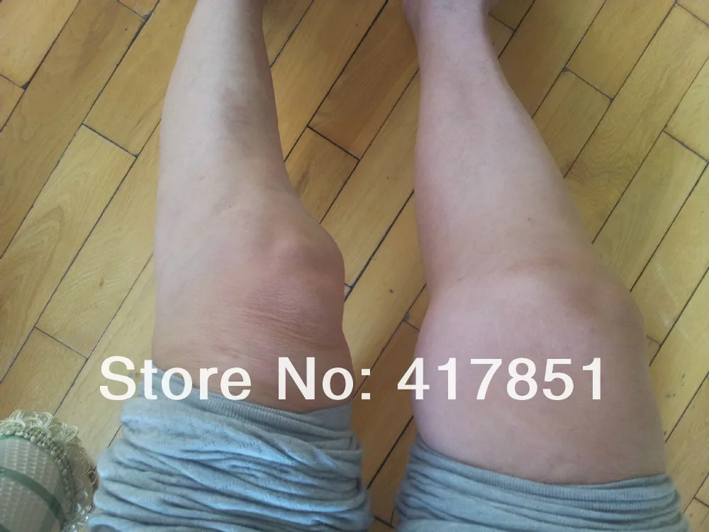 Борьба против ревматоидного артрита анкиллинга спондилита. Анти Ра и как