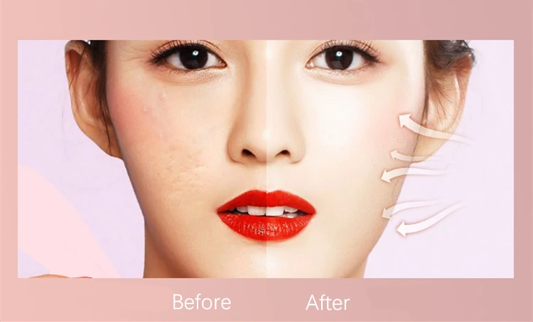 Agulha para Anti-envelhecimento Cuidados com a Pele Caneta Ultima Elétrica Auto Derma Máquina Micro Agulhas Livres 12pin Facail Dr. A1-c 10 High Quality Beleza e saúde