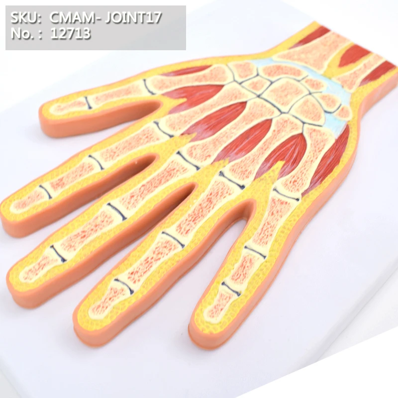 CMAM/12713 Hand Joint Section, Medical Extremities Anatomical Human