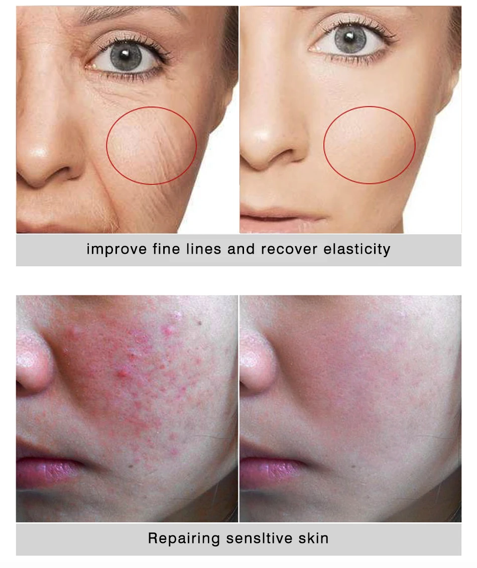 Rejuvenescimento da Pele Fator de Reparo Cuidados com a Pele Creme para o Rosto Senhora Soro Acne Tratamento Liofilizado pó Rosto Ageless Omy 15 tratamento fator de reparo liofilizado pó rosto