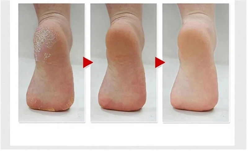 KM-2501-Feet-Care-Tool-Machine-Skin-Foot-Dead-Removal-Electric-Exfoliator-Heel-Cuticles-Remover-Pedicure (4)