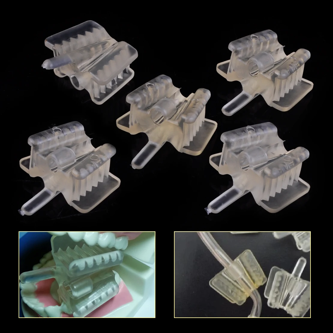 KUDOST 5pcs Dental Clear Silicone Mouth Support Prop Holding Saliva