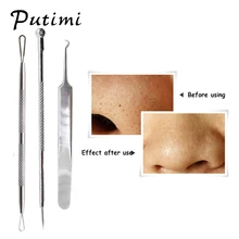 PUTIMI, 3 шт., набор для удаления прыщей, игла для удаления угрей, пинцет для удаления угрей, экстрактор, очищение пор, средство по уходу за лицом от прыщей, инструмент