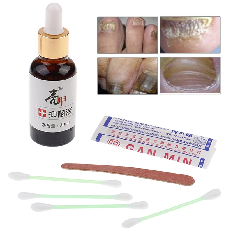 лечение ногтей волжский фуст