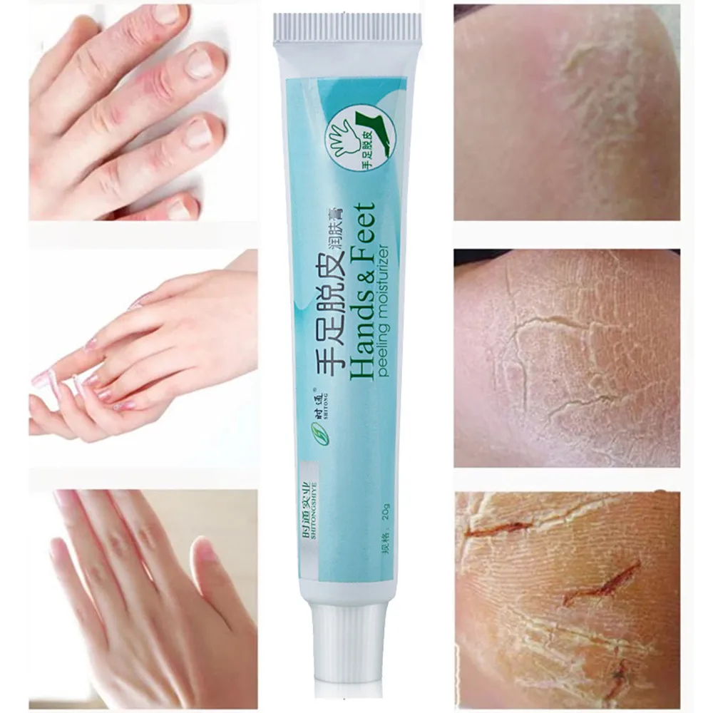 

Hand Feet Crack Cream Peeling Heel Chapped Foot Hand Repair Anti Dry Crack Skin Chinese Medicinal Ointment Cream Skin Care 827
