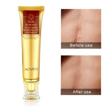 Крем для лица Удаление Шрама от акне крем для ухода за кожей лица отбеливающий улиточный крем растяжки питательный для лица