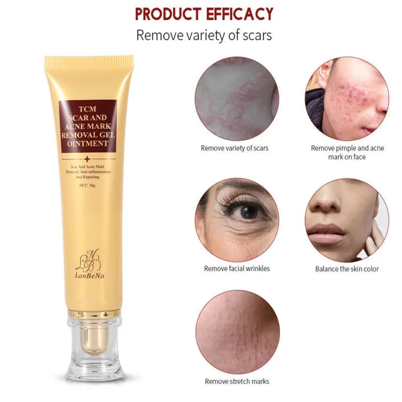 

LANBENA Acne Scar Removal Cream Skin Repair Face Cream Acne Spots Acne Treatment Blackhead Whitening Cream Stretch Marks 30ml