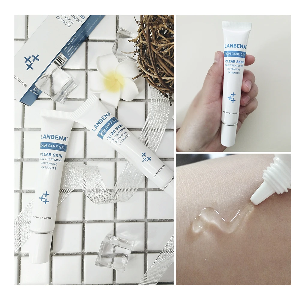 LANBENA 20g Cleaning Acne Treatment Gel Acne Cream Blackhead Remover Acne Spots Face Acne Scars Skin 1 LANBENA 20g Cleaning Acne Treatment Gel Acne Cream Blackhead Remover Acne Spots Face Acne Scars Skin 3