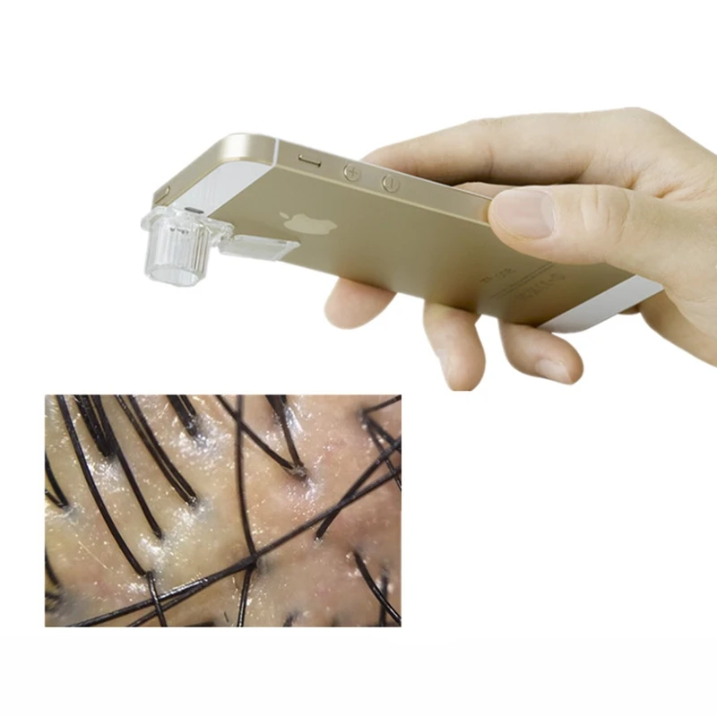 

Skin detection digital microscope check scalp hair follicle facial pores mobile phone microscope magnifying glass for skin