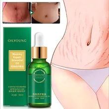 Удалите беременность шрамов масло от акне крем растяжки Лечение ремонт материнства против старения против морщин укрепляющие кремы для тела